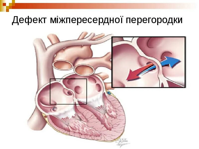 Описание пропало в параллельной вселенной.
