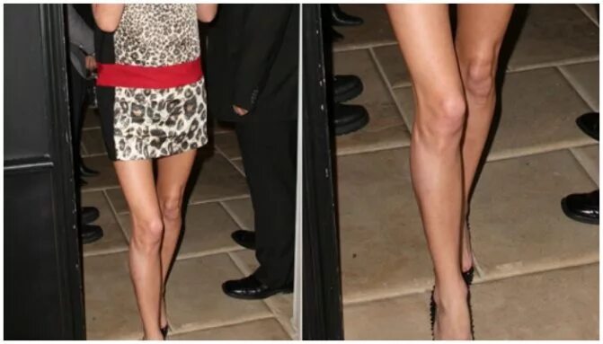 Анджелина джоли целлюлит. Красивые колени девушек. Коленки анджелины джоли. Торчащие коленки. Ровные ноги.