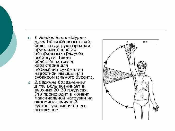 Болезненно тест. Дуга Дауборна тест. Симптом Дауборна. Болезненная дуга Дауборна. Симптом Дауборна характерен для.