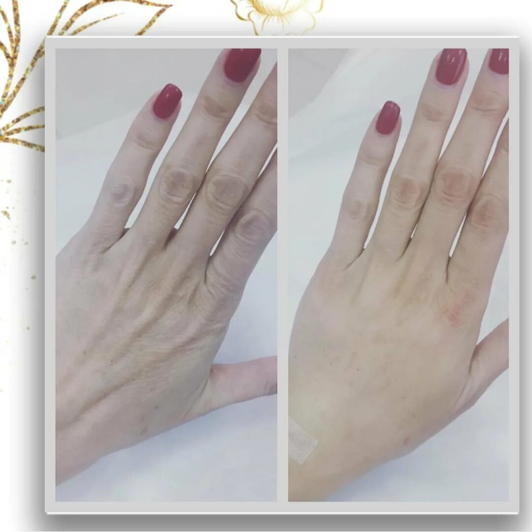 Упражнения на руки. Растяжка верха спины. Упражнения для кистей рук при ревматоидном артрите. Тренировка для укрепления кистей рук. Вращение кистей рук упражнение.