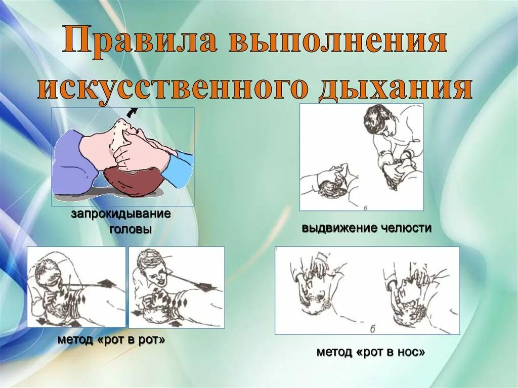 Порядок проведения искусственного дыхания. Правила выполнения искусственного дыхания. Порядок оказания искусственного дыхания. Правила осуществления искусственного дыхания.