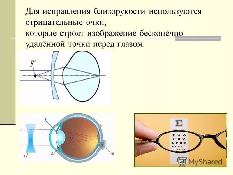 Очки для коррекции миопии. Нстроение глаза при близорукости. Очки для близоруких. Очки для близоруких и дальнозорких.