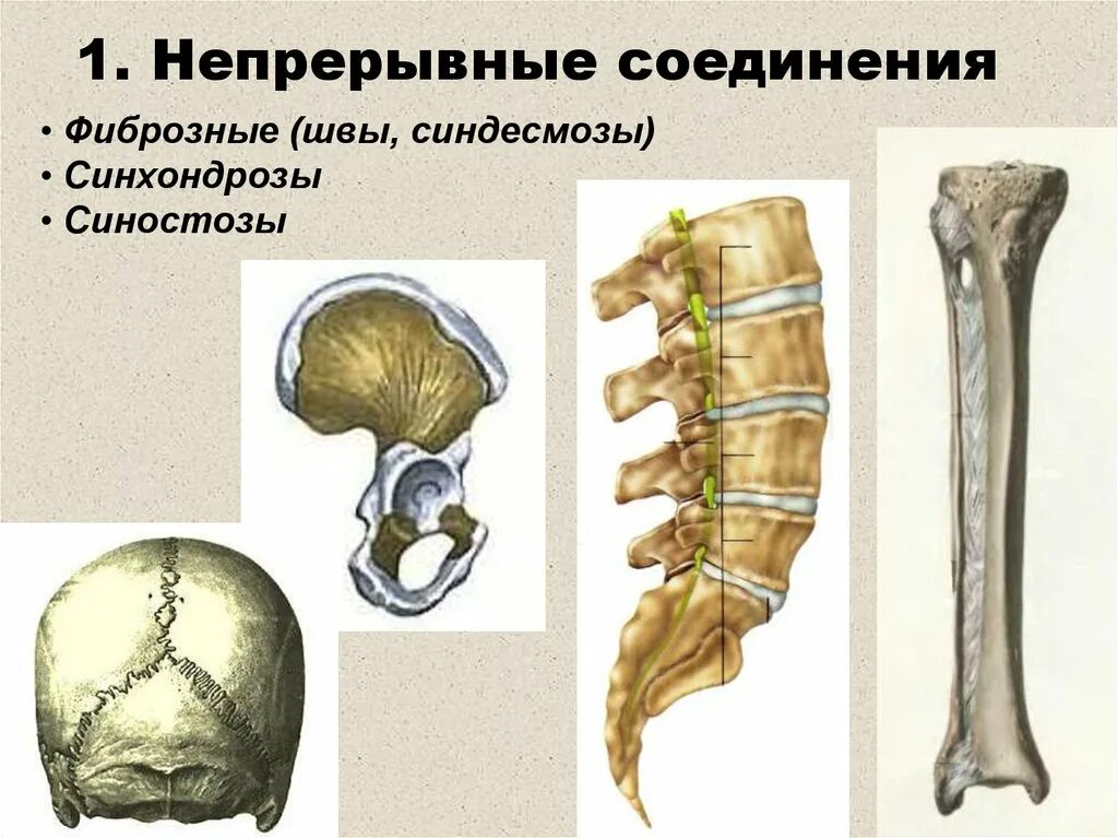 Соединение костей синдесмозы. Синдесмозы синхондрозы синостозы. Синхондроз синостоз. Непрерывные соединения костей синдесмозы синхондрозы.