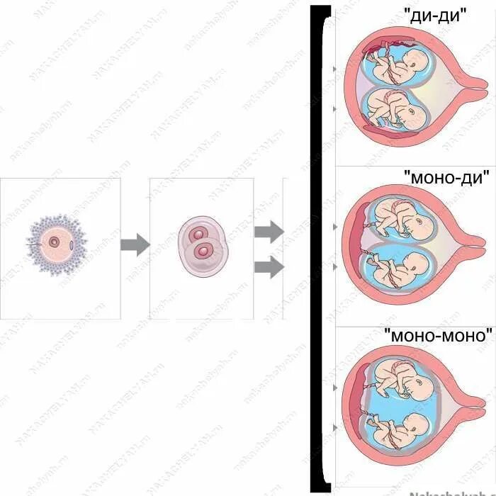 Двойная ди ди. Однояйцевая беременность. Однояйцевые двойни образуются при оплодотворении. Однояйцевые Близнецы деление яйцеклетки. Однояйцевые Близнецы эмбрион.