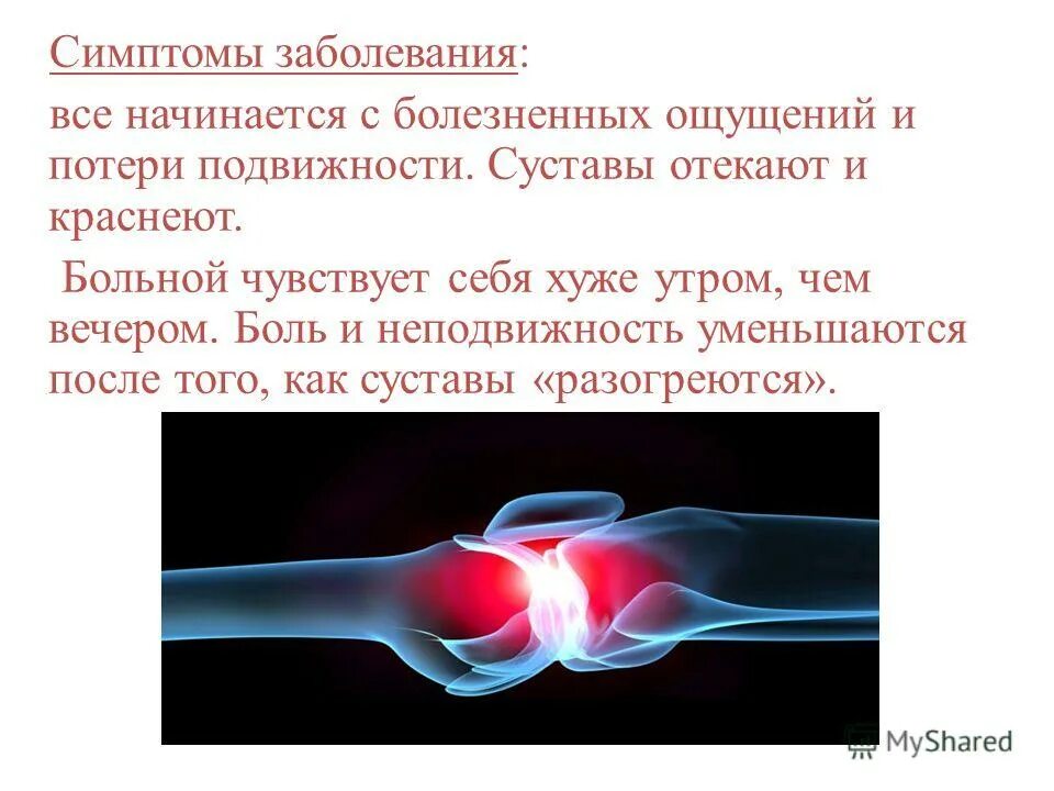 ревматоидный артрит полиартрит. ревматоидный артрит очаги поражения. симптомы заболеваний суставов. причины заболевания суставов. ревматический артрит симптомы.