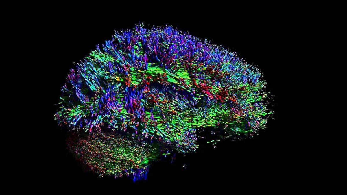 Коннектом мозга. Нейронная сеть мозга. Визуализация мозга. Мозг нейросеть.