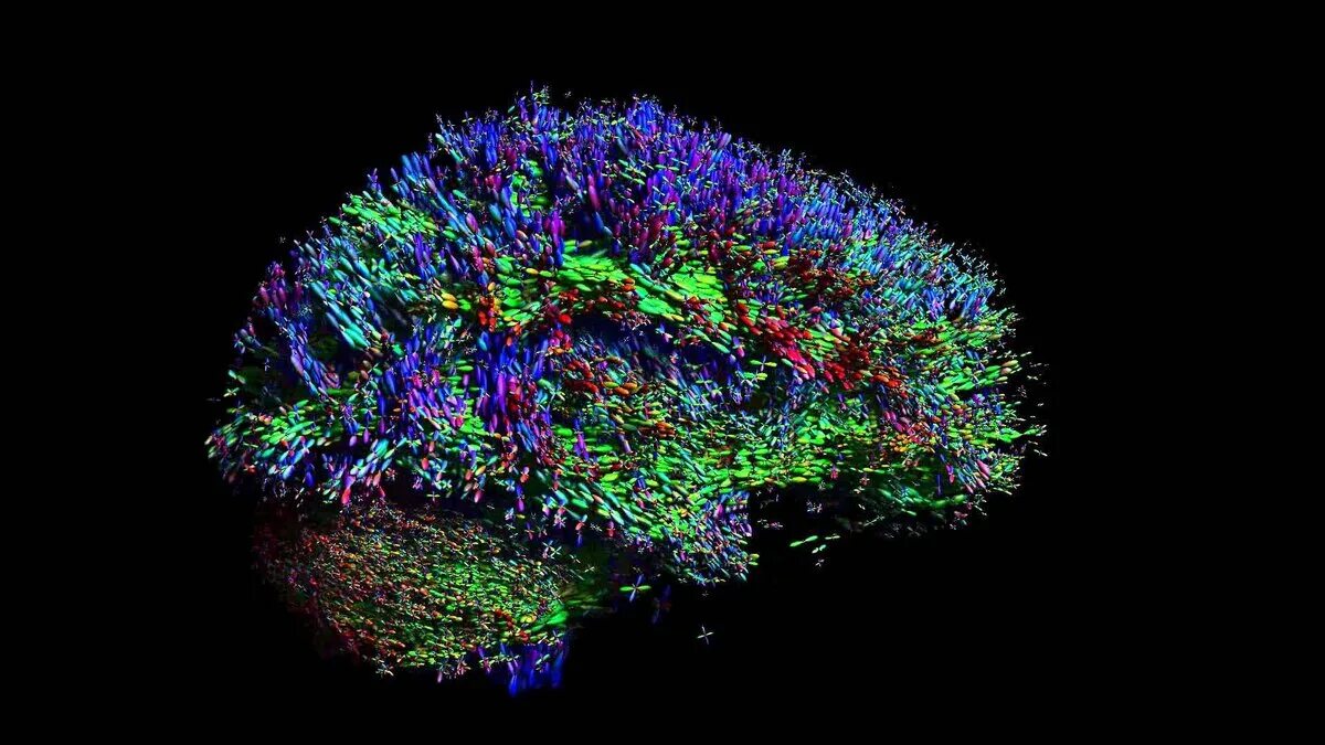 F neural network