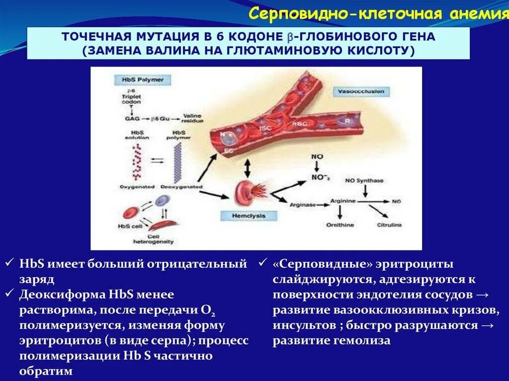 Серповидноклеточная анемия какая. Гематологические критерии серповидноклеточной анемии. Строение гемоглобина при серповидноклеточной анемии. Тип гемолиза при серповидноклеточной анемии. Молекулярный механизм серповидноклеточной анемии.