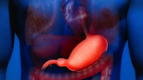 Uzmandan Gastroskopi Uyarısı (1) 