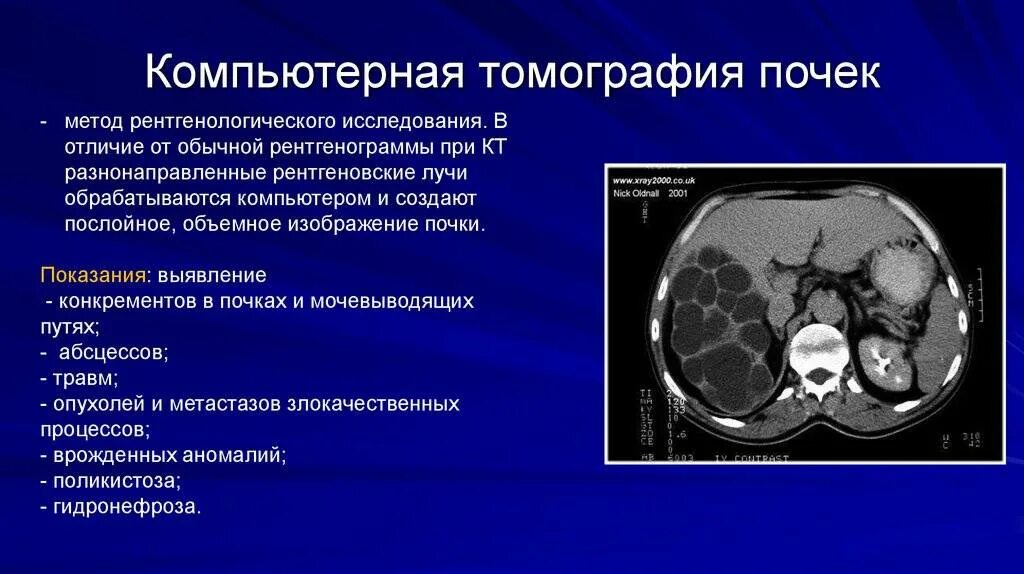 Как подготовиться к кт с контрастом почек. Магнитно-резонансная томография метод исследования. кт почек диагностическая значимость. кт почек с контрастированием норма. компьютерная томография почек.