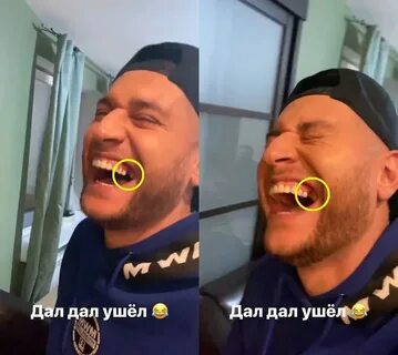 Давай сделал зубы