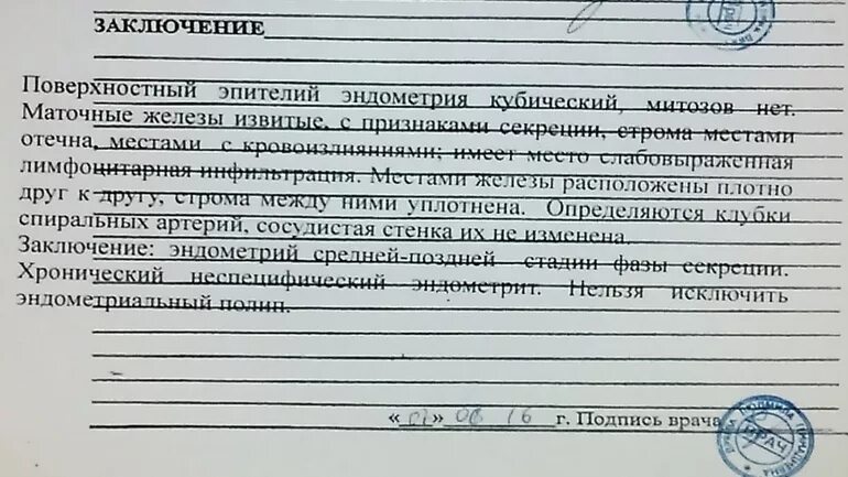 Результат гистологии эндометрия. Протокол пайпель биопсии эндометрия. заключение пайпель биопсии эндометрия. заключение пайпель биопсии. аспирационная биопсия эндометрия заключение.
