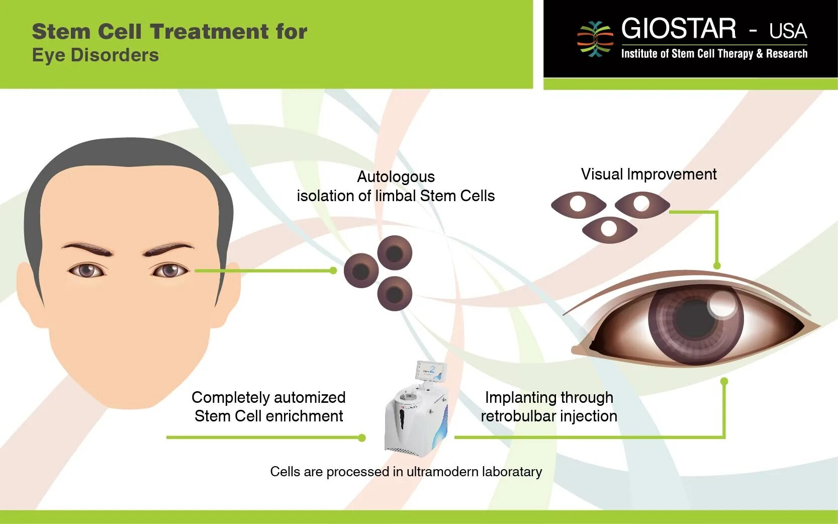 Cell effect. Стволовые клетки в офтальмологии. Stem Cells Eye.