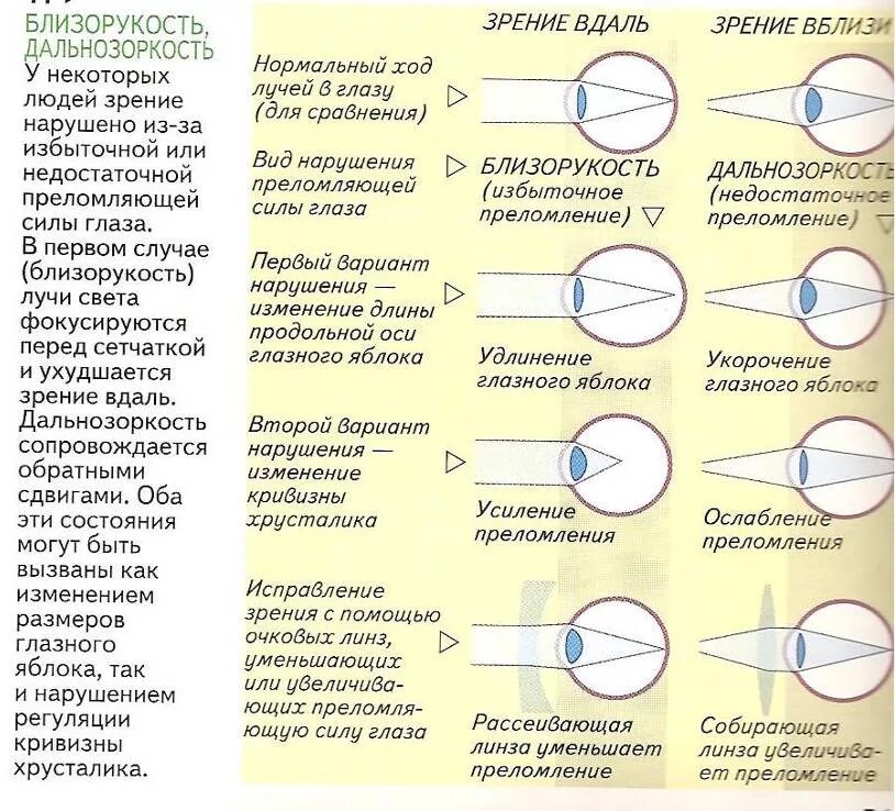 Какое зрение при дальнозоркости. Кривизна хрусталика ниже нормы при близорукости или дальнозоркости. Кривизна хрусталика при дальнозоркости. Аномалии рефракции таблица близорукость дальнозоркость. Аномалии рефракции глаза близорукость дальнозоркость таблица.