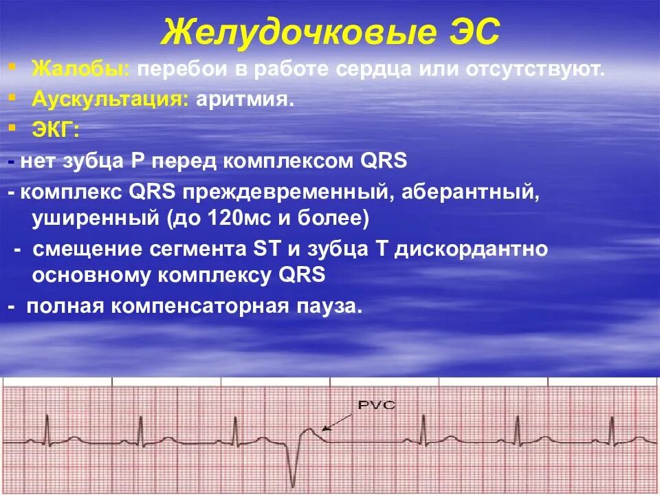 Деформированный зубец р