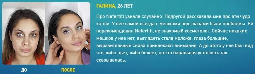 Гепариновая мазь от синяков под глазами. Гепариновая мазь от мешков под глазами фото до и после. Мази от синяков под глазами и отеков. Гепариновая мазь от мешков под глазами.