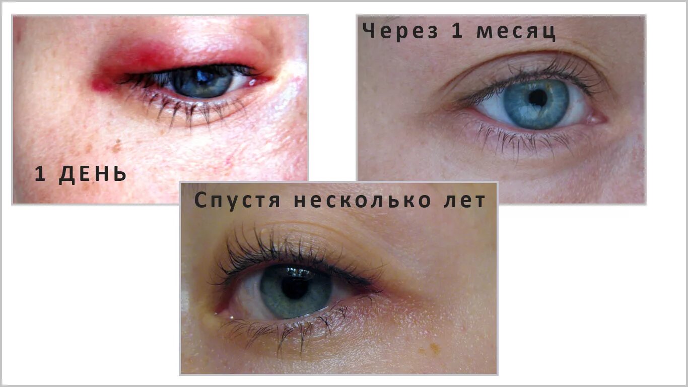 Татуаж век. Перманентный макияж глаз. Перманентный макияж глаз межресничный до и после. Перманентный макияж век до и после заживления.