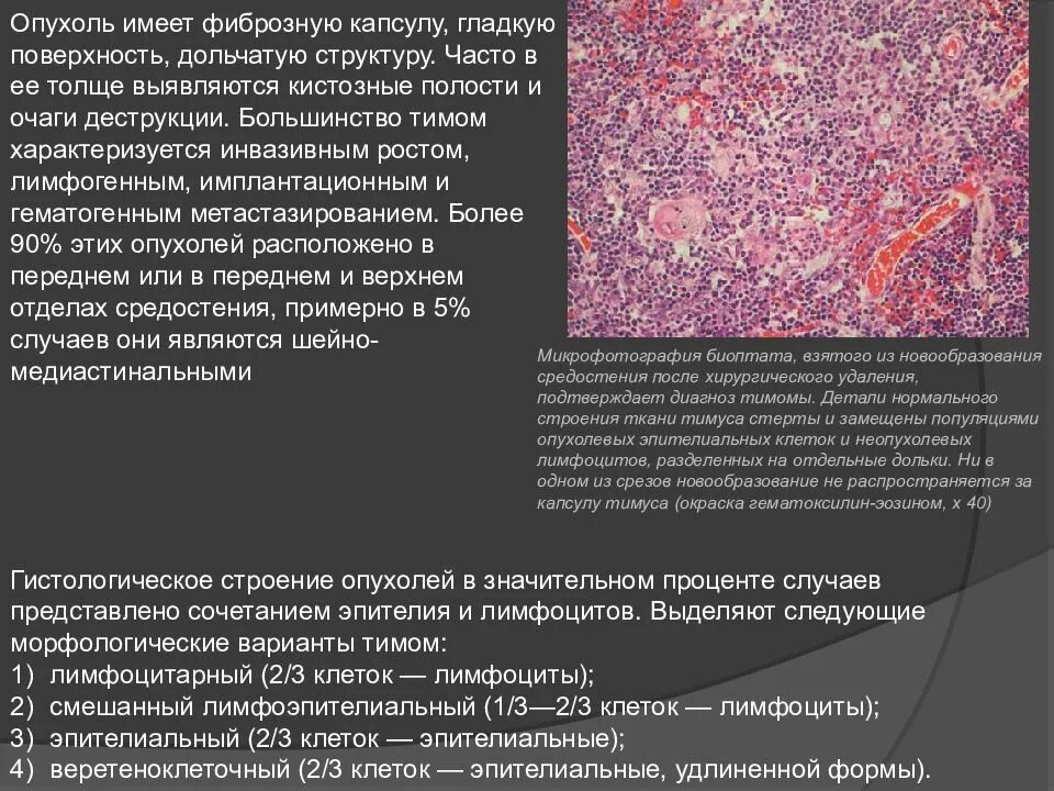 Гистологическое строение опухоли. Гистологическая структура злокачественных опухолей. Опухоль в капсуле