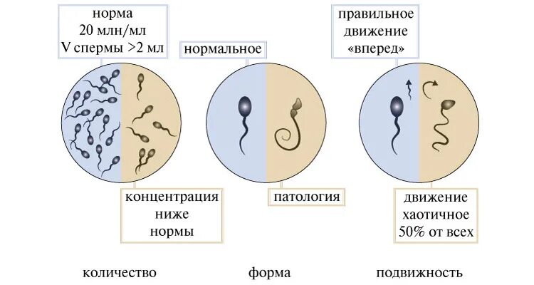 Как влияет курение на мужчин. Спермограмма курильщика. Сперматозоиды курильщика. Сперматозоиды курящего человека. Сигареты влияют на спермограмму.