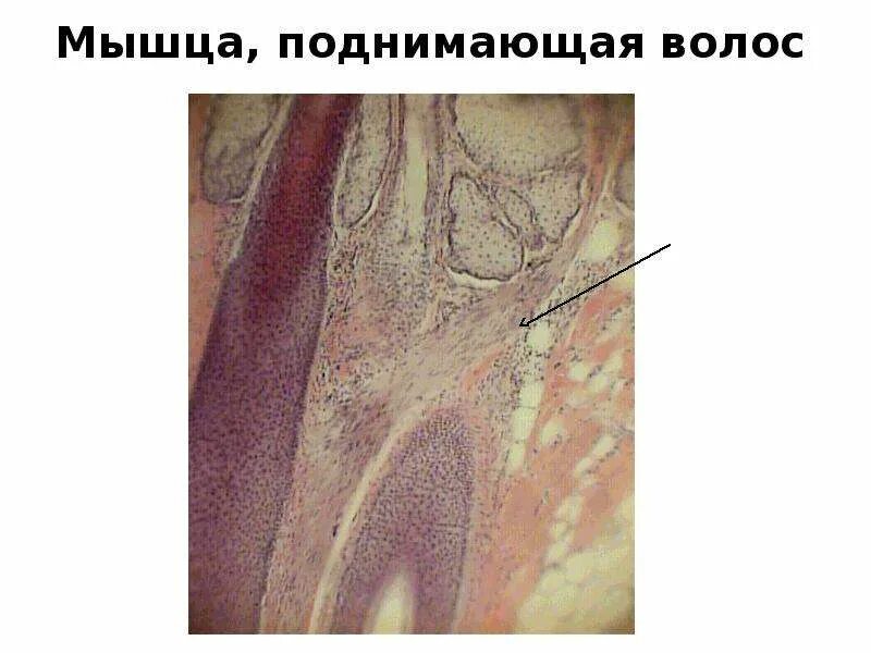 Кожа головы гистология препарат. Мышца поднимающая волос гистология. Мышца поднимающая волосок. Мышца приподнимающая вооос.