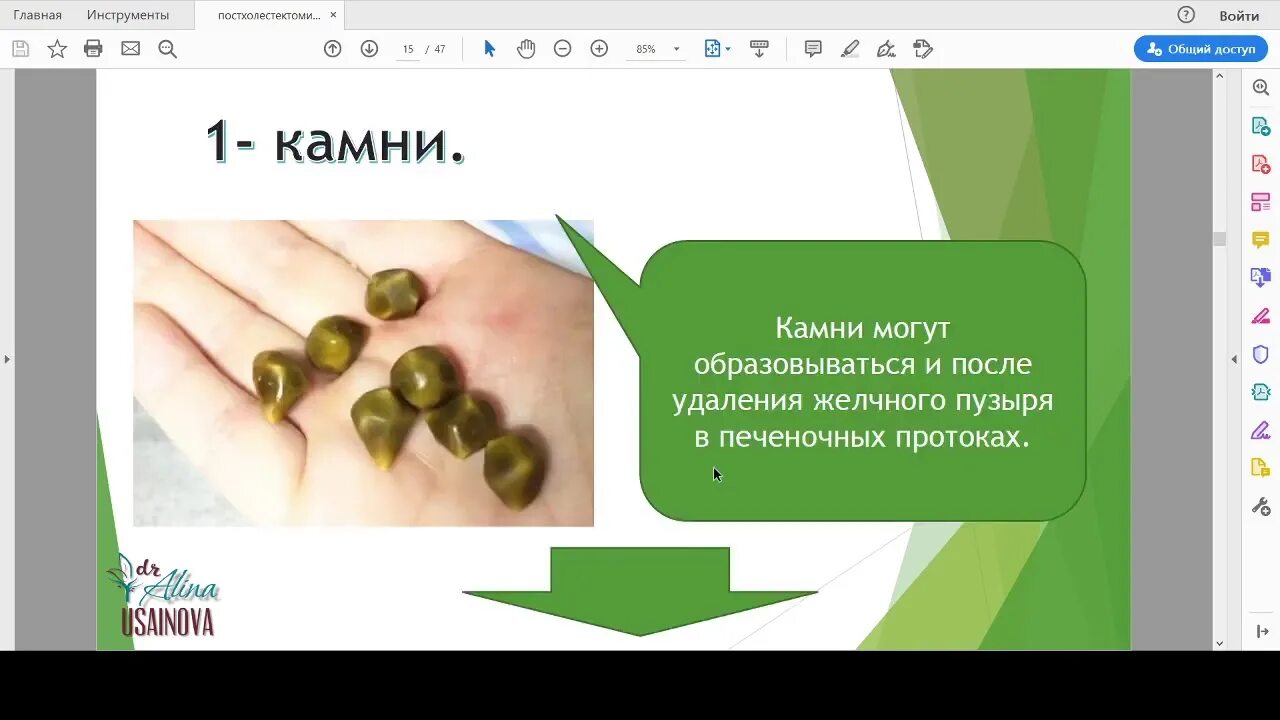 Диета после операции после удаления желчного пузыря. Диета при удаленном желчном пузыре. Удалённый желчный пузырь диета. Желчный пузырь диета после удаления желчного пузыря. После операция кушать камни