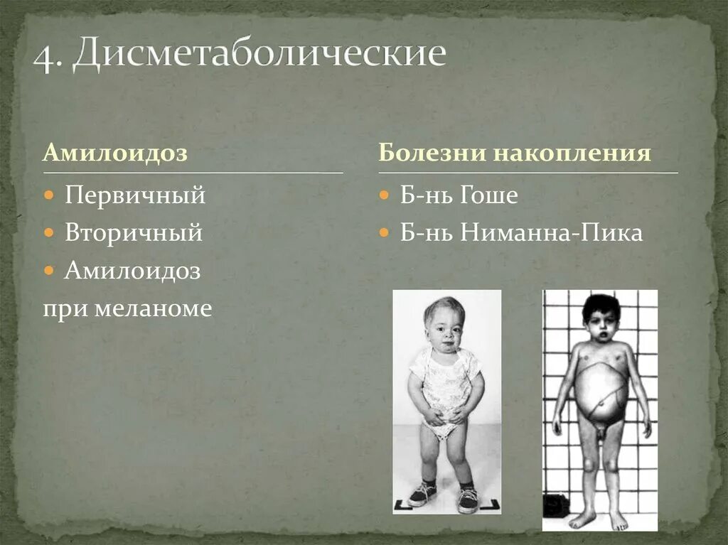 Болезнь ниманна пика тип а. Болезнь ниманна-пика, болезнь гоше. болезни накопления ниманна пика. болезнь нимана пика тип с.