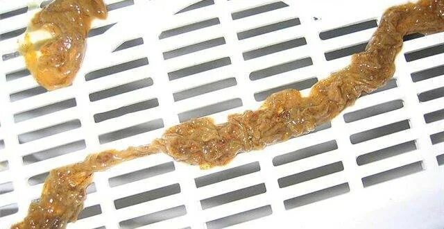 Водорослеобразные ленточные черви. Непереваренная пища в Кале. Метеоризм слизь