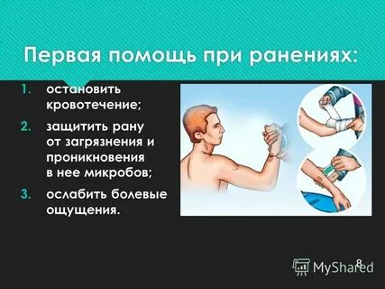 Кровотечение обж 8 класс