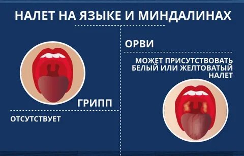 Язык при орви