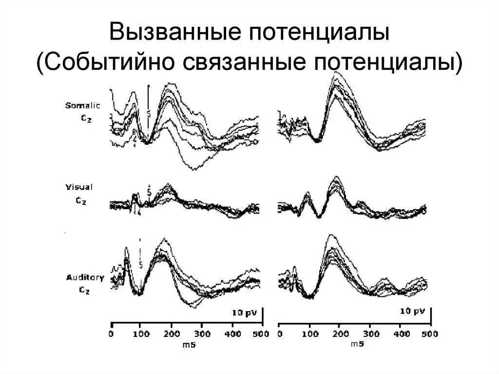 Потенциал ээг. Вызванные потенциалы и потенциалы, связанные с событиями. (Электроэнцефалограмма, вызванные потенциалы). Методика вызванных потенциалов. Метод вызванных потенциалов психофизиология.