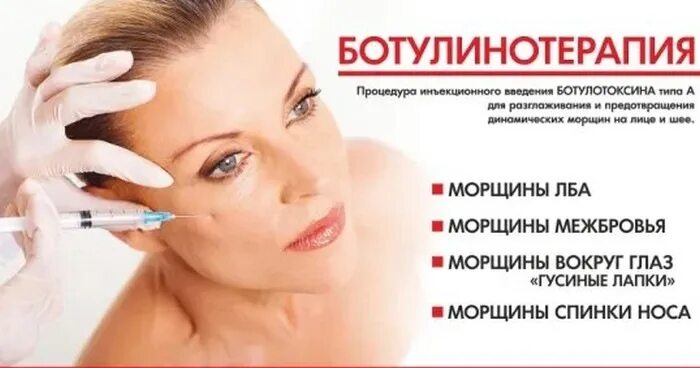 Что нельзя после ботулинотерапии. Препараты ботулотоксина. препараты для ботулинотерапии. ботулинотерапия лица. диспорт.