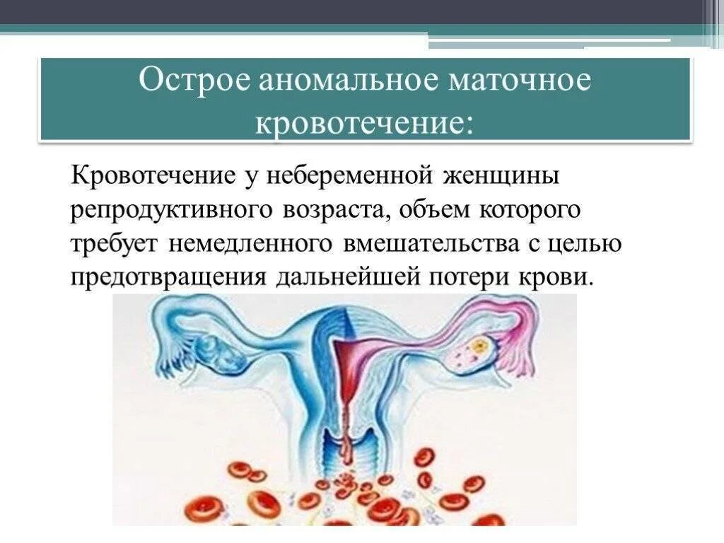 Почему кровоточит после. Аномальные маточные кровотечения. Молочное кровотечение. Маточное кровотечение причины. Гемотомное кровотечение.