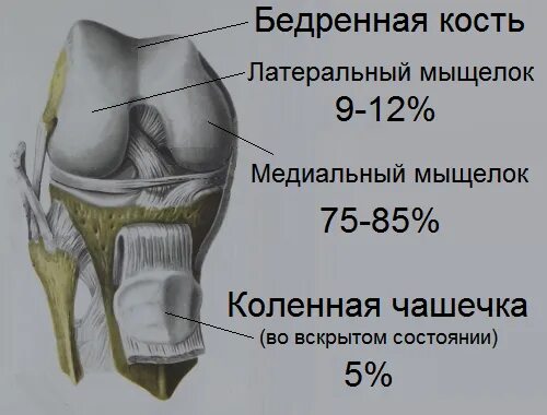 Болезнь Кенига коленного. Медиальные мыщелки коленного сустава. Рассекающий остеохондрит коленного сустава локализации. Рассекающий остеохондрит коленного сустава мрт.