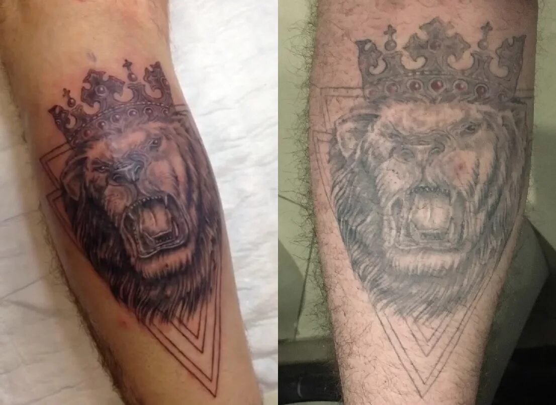 Татуировки спустя время. Татуировка выцветает. Выцветать татуироваа. Тату спустя год. Выцветшая тату.