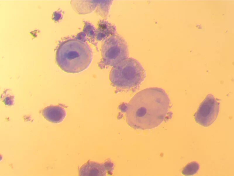 Хламидии трихомонады микоплазма. Трихомонада микроскопия. Хламидиоз микроскопия мазка. Микроскопия мазка трихомонады. Трихомониаз микроскопия мазка.
