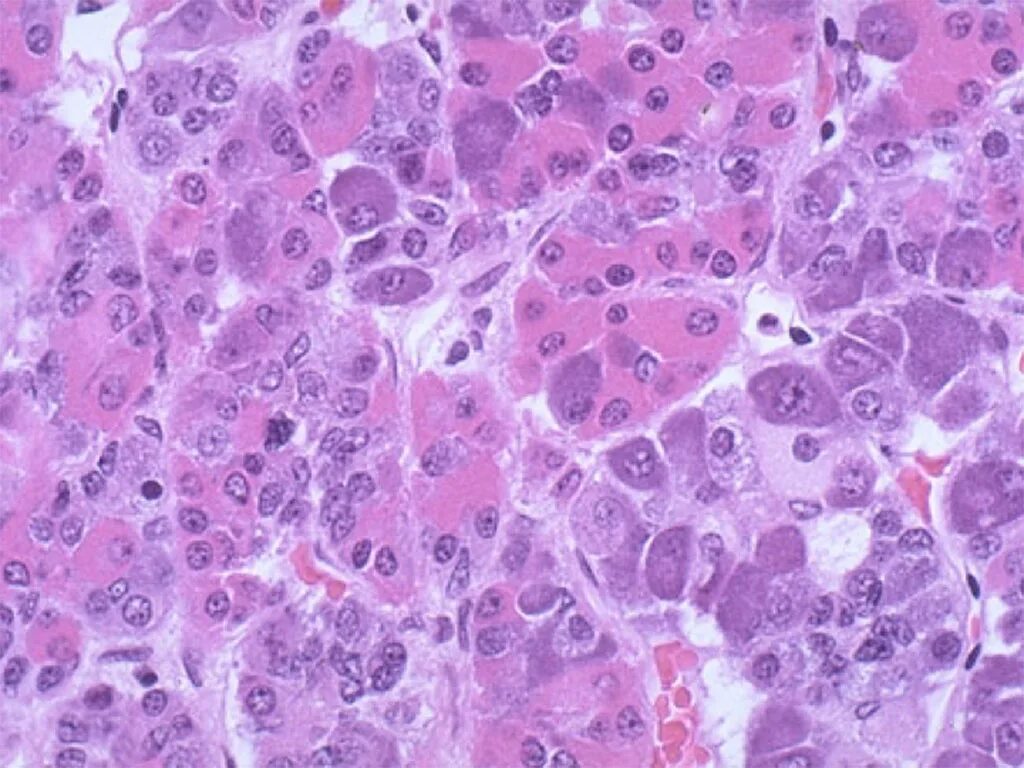 Гипофиз окраска гематоксилином и эозином. Аденогипофиз гистология препарат. Препарат передней доли гипофиза гистология. Аденогипофиз гистология препарат. Передняя доля аденогипофиз гистология.