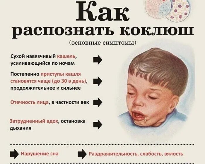 Сильный кашель от горла. Лицо больного при коклюше. Ребенок кашляет. Коклюш у ребенка симптомы детей до года.