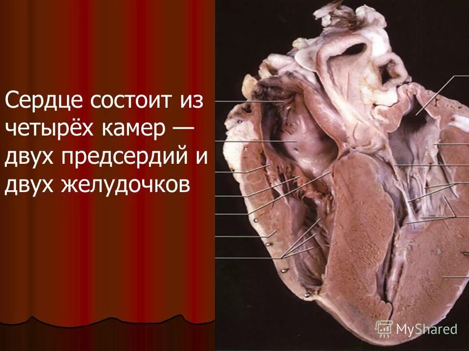 сердце правое предсердие левое предсердие желудочек. нормальная анатомия сердца. сердце состоит из предсердий и желудочков. сердце анатомия желудочки и предсердия. сердечные клапаны между предсердием и желудочком.