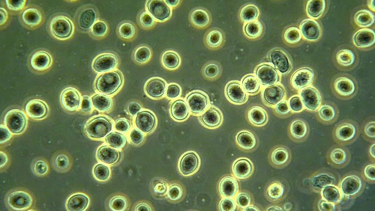 Оборудование для изучения клеток дрожжевых грибов. Дрожжей Saccharomyces cerevisiae микроскопия. Saccharomyces Minor под микроскопом. Saccharomyces Minor дрожжи. Saccharomyces грибы.