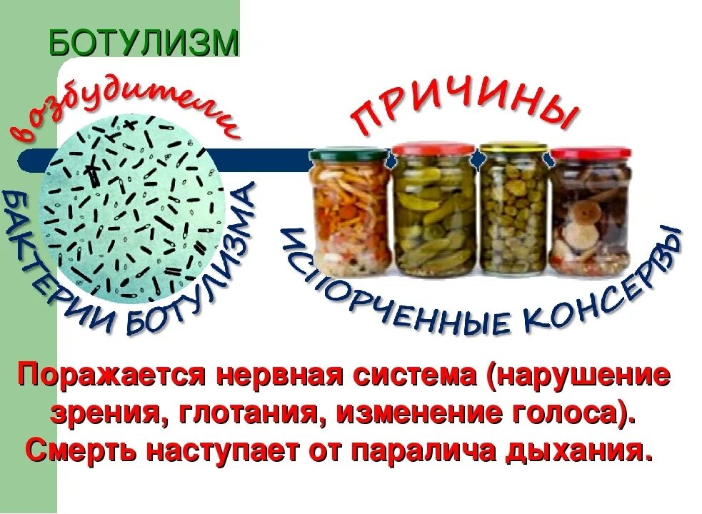 Чаще всего ботулизм связан с употреблением ответ. Ботулизм схема заражения. Пищевые отравления таблица ботулизм. Пищевое отравление ботулизм возбудитель.