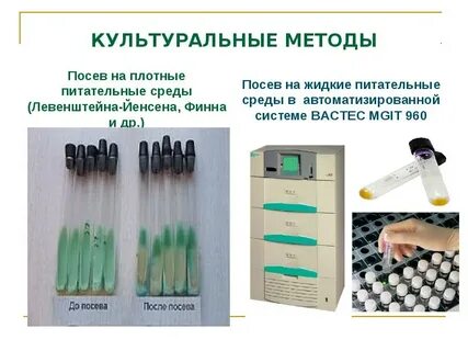 Методы обнаружения мбт