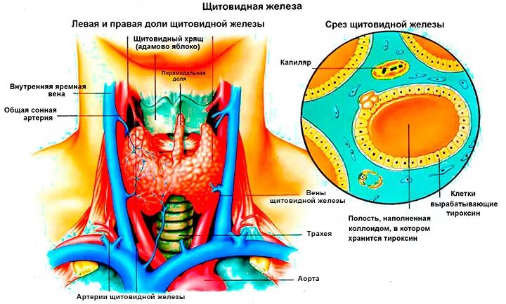 Почему образуются узлы. Узелки щитовидной железы. Узлы в щитовидной железе.