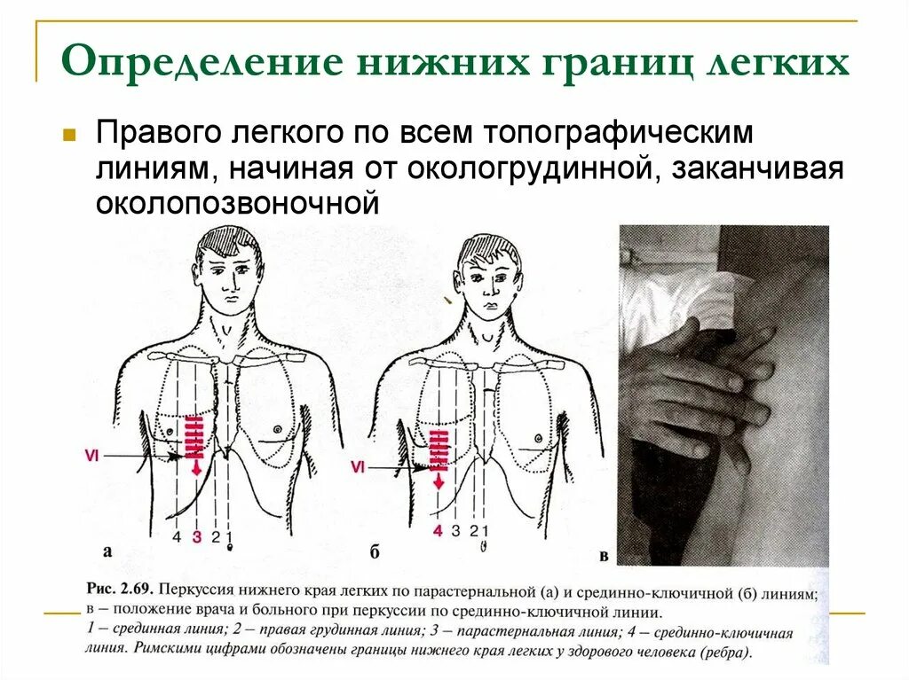 Топографическая перкуссия грудной клетки. Топографическая перкуссия грудной клетки пропедевтика. Топографическая перкуссия легких пропедевтика внутренних болезней. Сравнительная перкуссия легких пропедевтика. Границы легких определяются