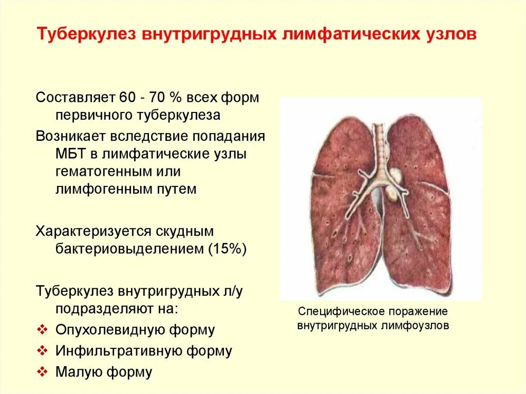 Туберкулез учебник