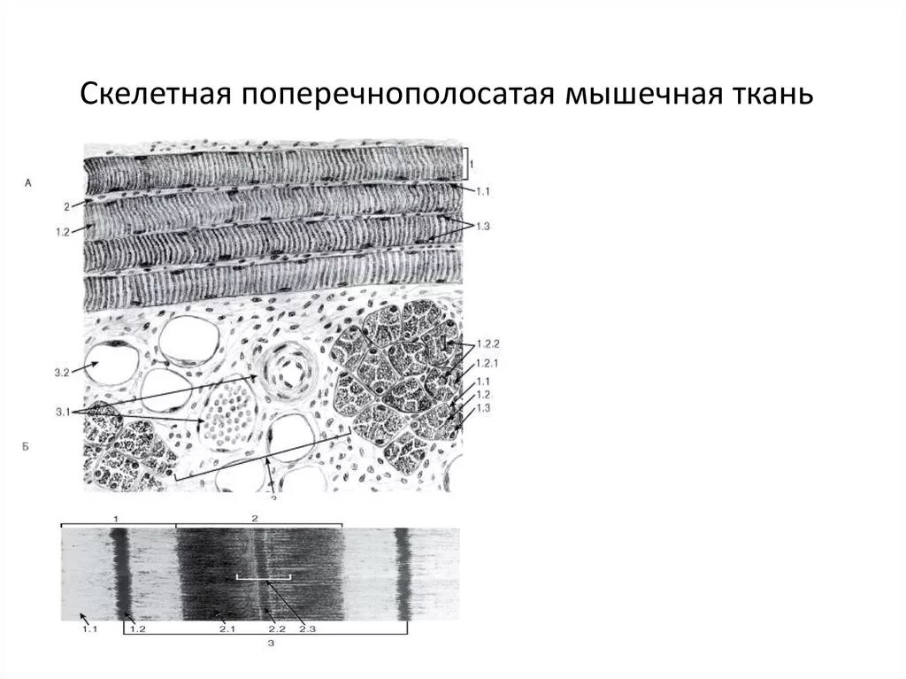 Изображение поперечно полосатой скелетной мышечной ткани. Скелетная мышечная ткань Электронограмма. Поперечно-полосатая мышечная ткань Электронограмма. Скелетная мышечная ткань гистология Электронограмма. Микрофотография скелетной мышечной ткани.