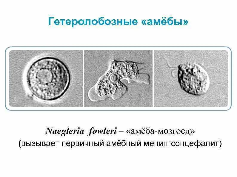 Заражение амебой неглерия фоулера. Амеба поедающая мозг где обитает. Неглерия циста. Неглерия циста. Амеба поедающая мозг где обитает.