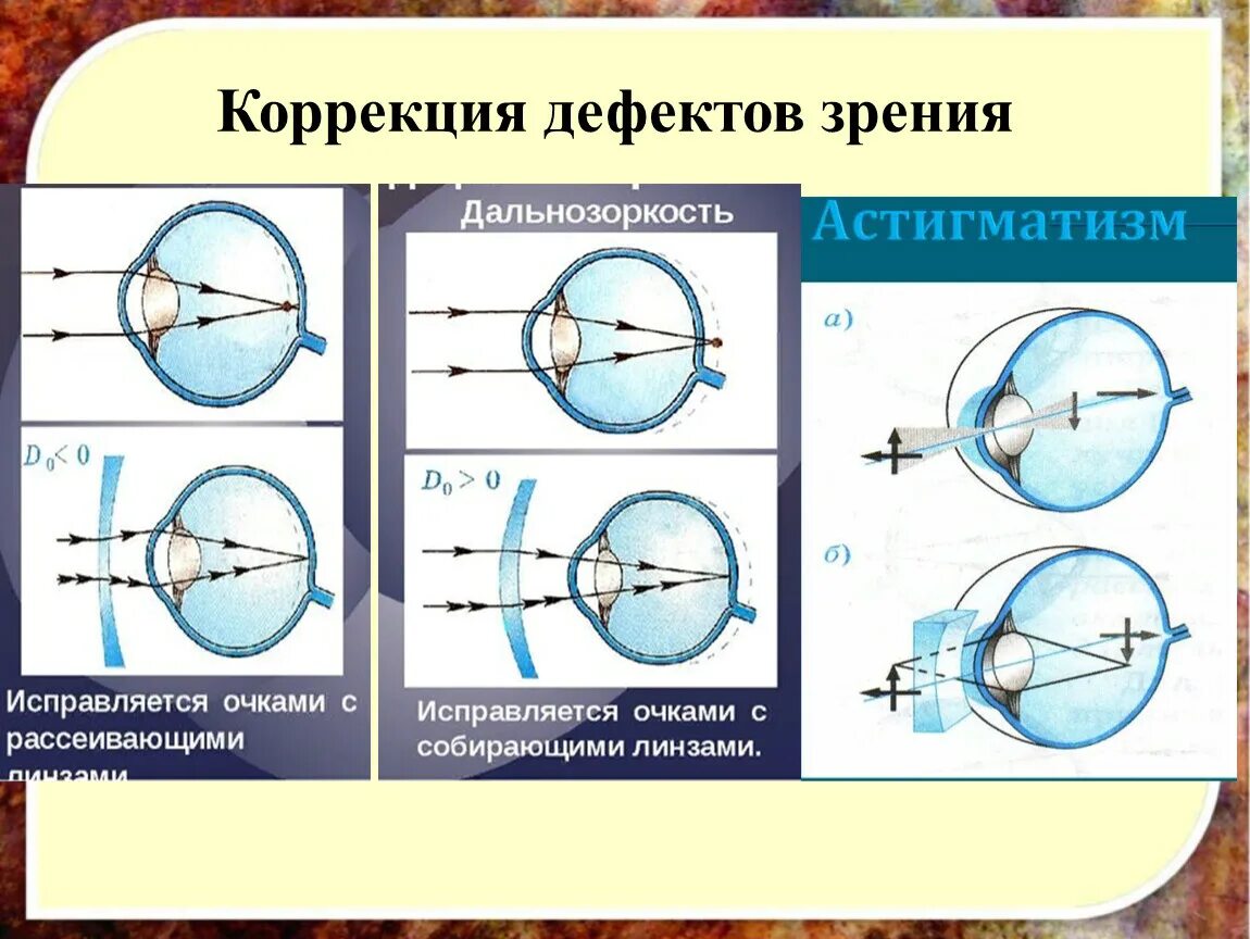 Дефекты зрения ответы. Дефекты зрения. Дефекты зрения и их коррекция. Исправление дефектов зрения. Способы исправления дефектов зрения.