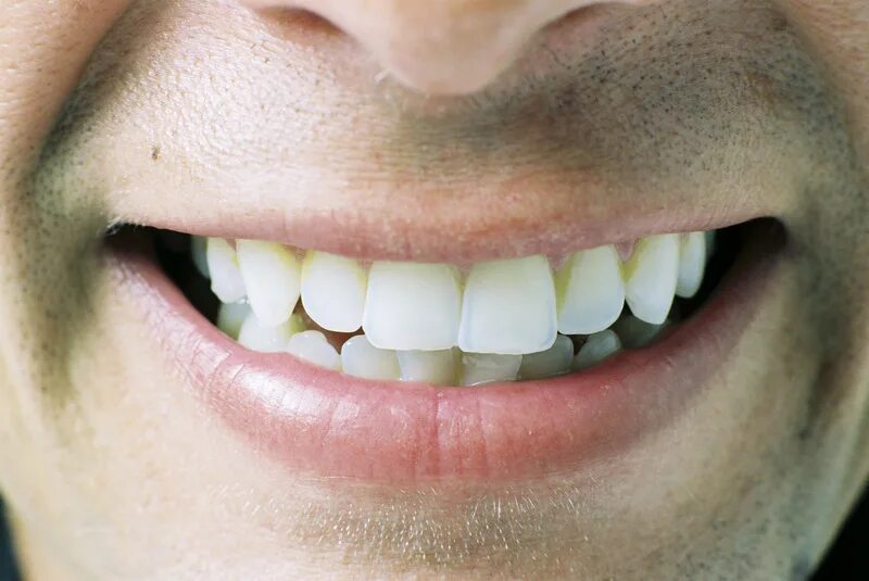 Teeth are like