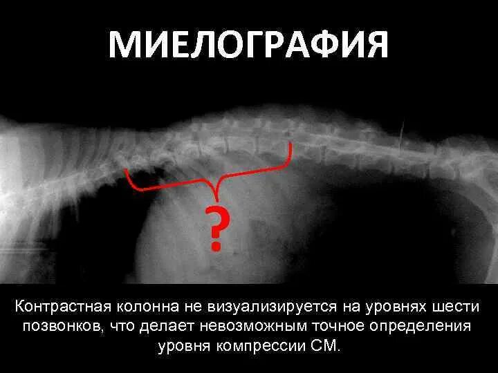 Что значит маточные трубы не визуализируются