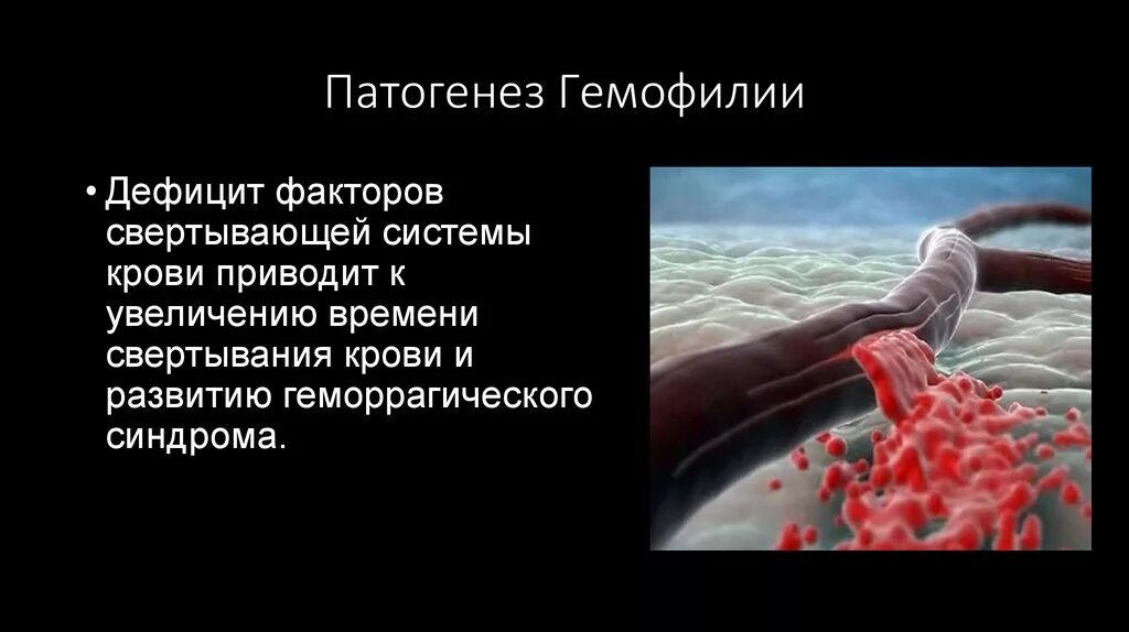 Этиология гемофилии. Этиология гемофилии. Гемофилия патогенез схема. Гемофилия этиология. Гемофилия факторы риска.